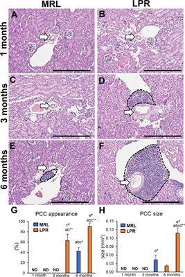 Vasculature-Associated Lymphoid Tissue: A Unique Tertiary Lymphoid Tissue Correlates With Renal Lesions in Lupus Nephritis Mouse Model